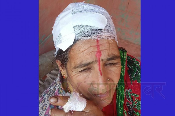 बैतडीमा बाँदरको आक्रमणबाट एक महिला घाइते 